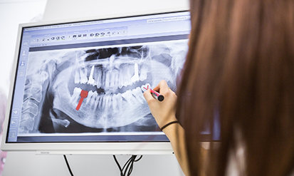 Dentist showing a patient an x-ray of their teeth