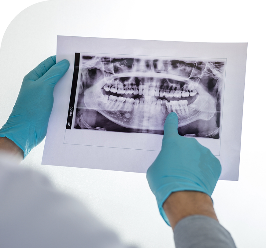Dentist looking at an x-ray of a patient's teeth