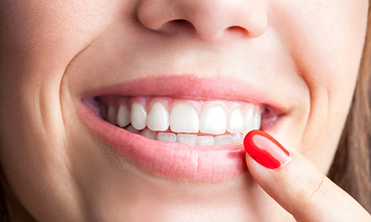 Woman pointing to her flawlessly white teeth