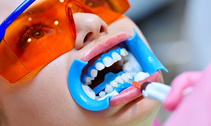 Dental patient getting their teeth whitened in the treatment chair
