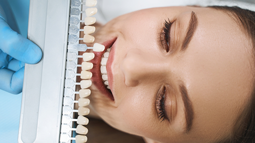 Dentist holding a shade guide to a woman's smile