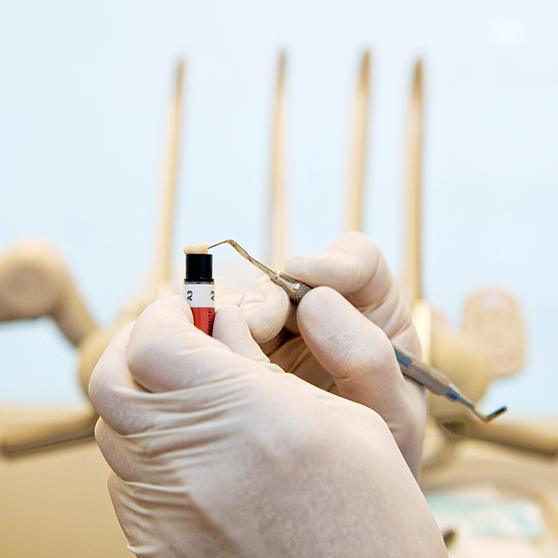 A dentist working with a special composite resin