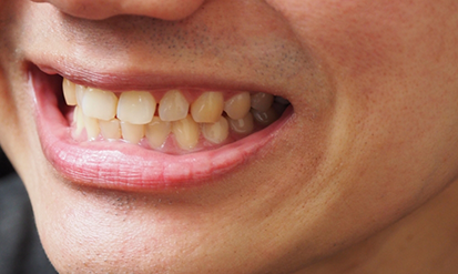 Close up of a mouth with slightly gapped teeth
